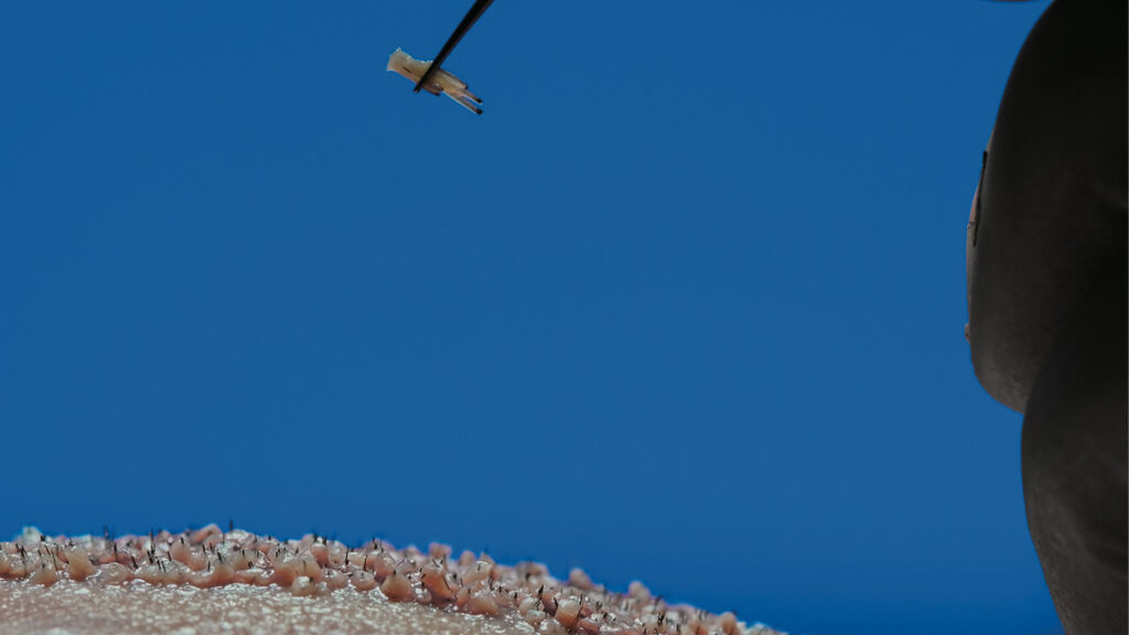 Dr. Harun Alakaya kliniği teknikleri