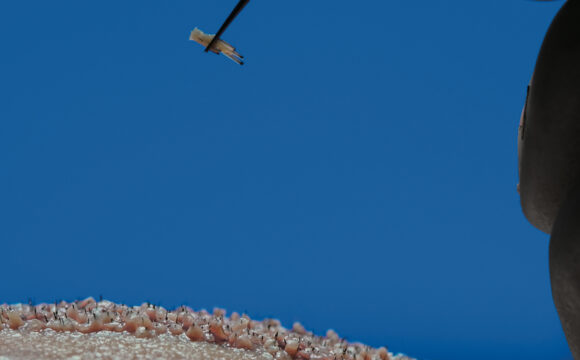 Dr. Harun Alakaya kliniği teknikleri