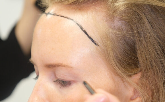 Dr. Harun Alakaya kliniği saç işlemi öncesi