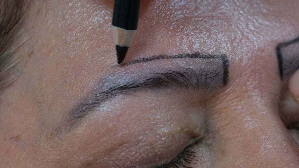 Dr. Harun Alakaya kliniği kaş işlemi öncesi