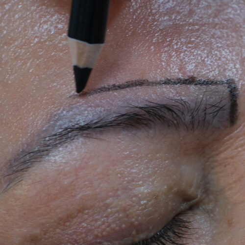 Dr. Harun Alakaya kliniği kaş işlemi öncesi