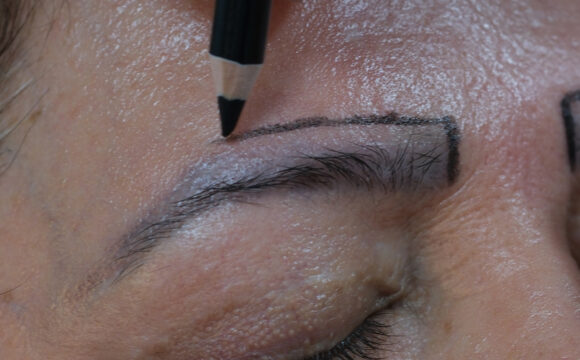 Dr. Harun Alakaya kliniği kaş işlemi öncesi