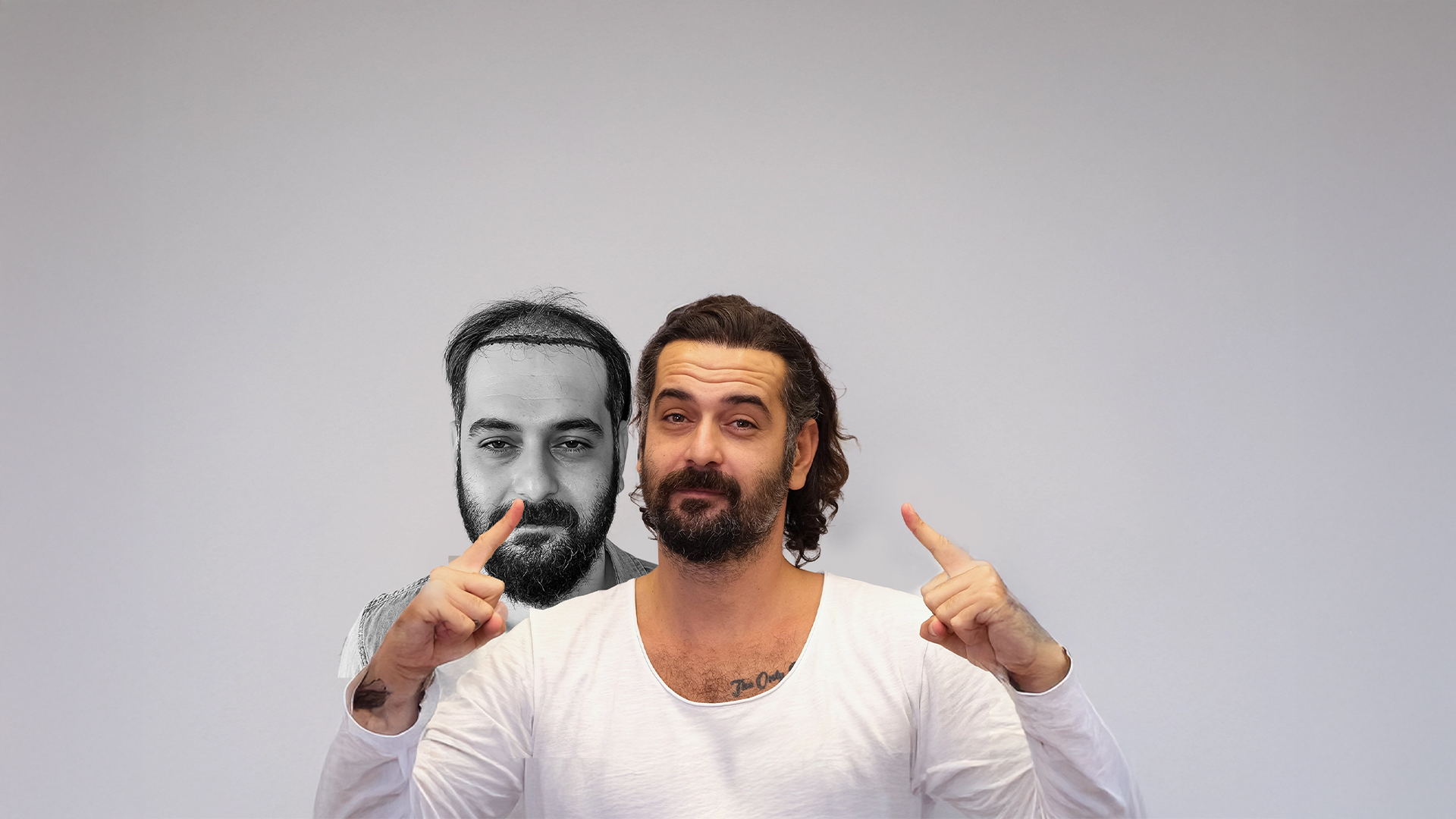 Dr.Harun Alakaya İşlem Öncesi ve Sonrası